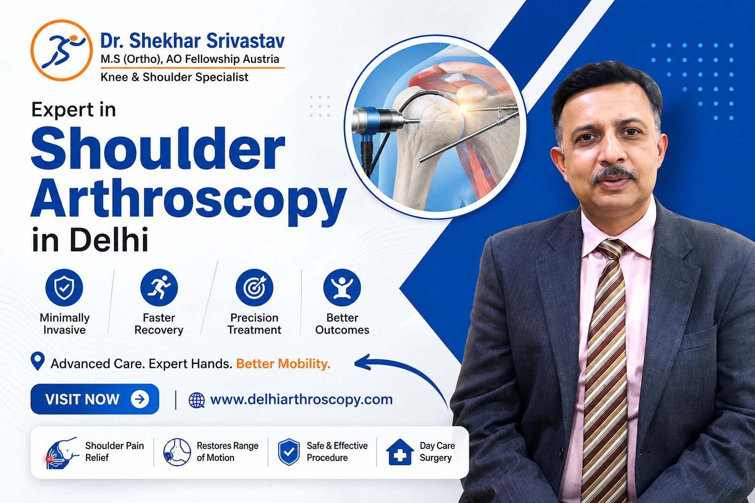 Shoulder Arthroscopy in Delhi