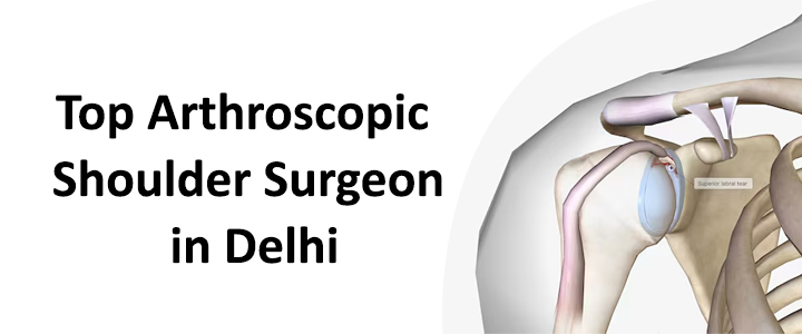 Top Arthroscopic Shoulder Surgeon in Delhi