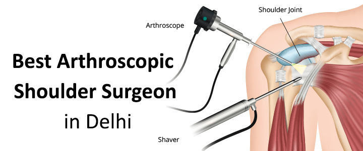 Best Arthroscopic Shoulder Surgeon in Delhi