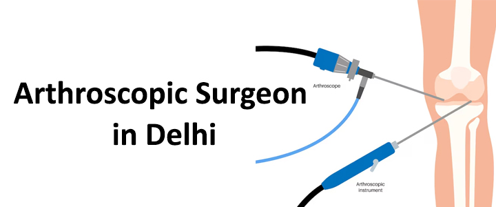 Arthroscopic Surgeon in Delhi