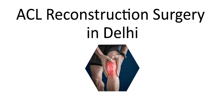 ACL Reconstruction Surgery in Delhi