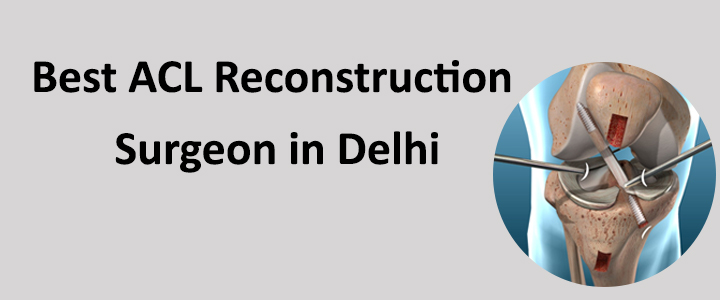 Best ACL Reconstruction Surgeon in Delhi