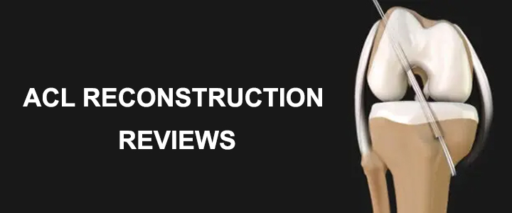 ACL Reconstruction Delhi Reviews