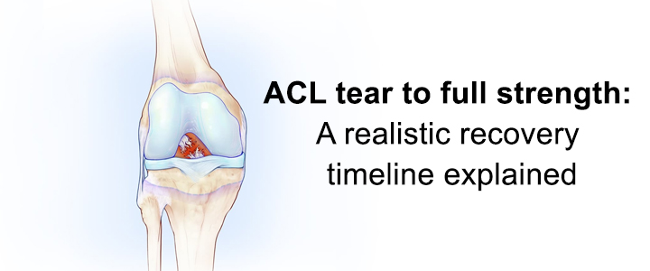 ACL Tear to Full Strength: A Realistic Recovery Timeline Explained