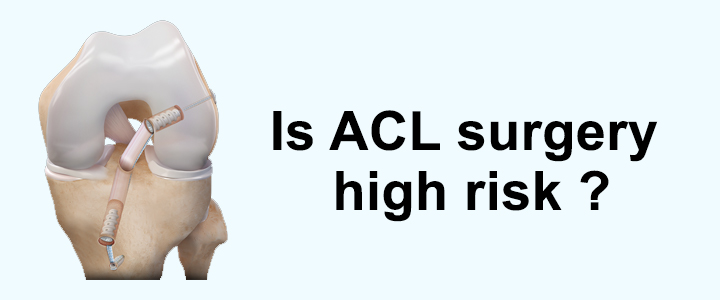 Is ACL Surgery High Risk?