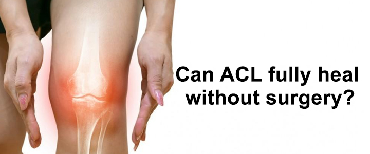 Can ACL fully heal without surgery?