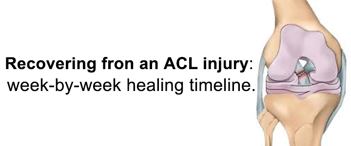 Recovering from an ACL Injury: Week-by-Week Healing Timeline