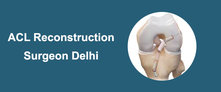 ACL Reconstruction Surgeon Delhi