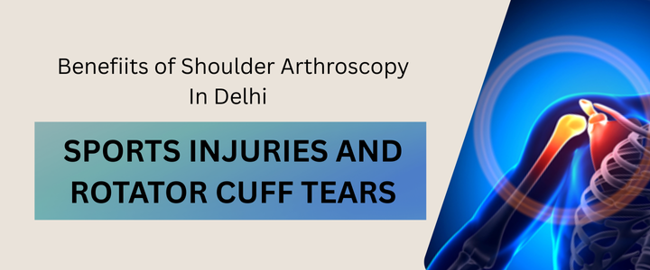 Shoulder Arthroscopy in Delhi