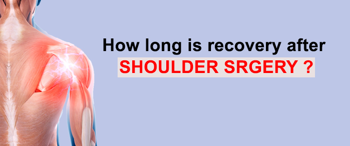 How Long is Recovery After Shoulder Surgery?