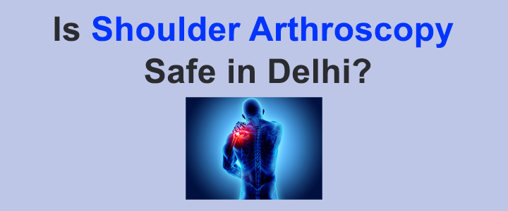 Is Shoulder Arthroscopy Safe in Delhi?