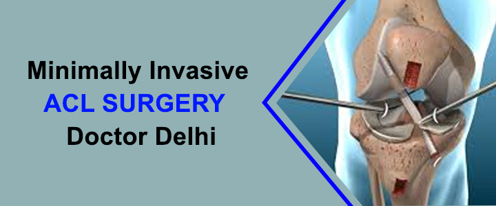 Minimally Invasive ACL Surgery Doctor Delhi