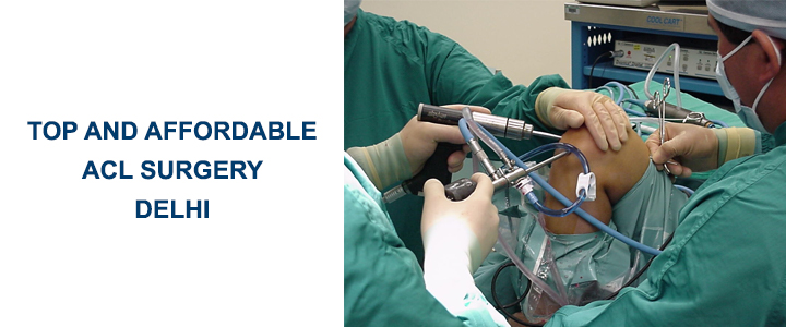 Top and Affordable ACL Surgery Delhi