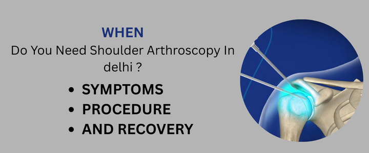 When Do You Need Shoulder Arthroscopy in Delhi? Symptoms, Procedure, and Recovery