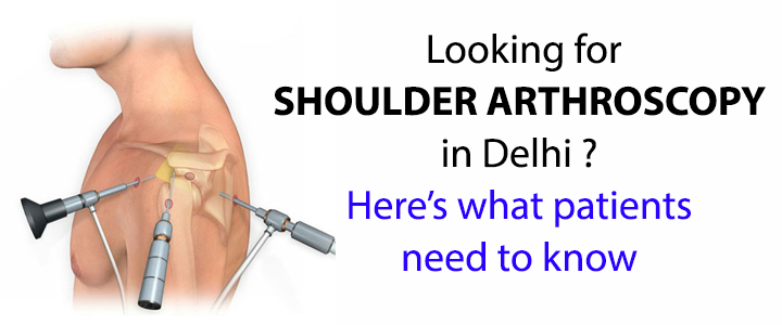 Shoulder Arthroscopy in Delhi
