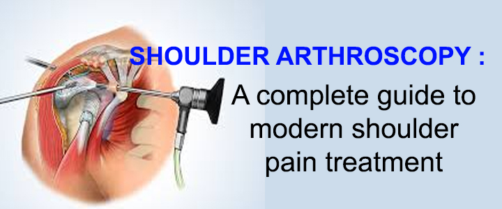 Shoulder Arthroscopy in Delhi