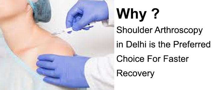 Shoulder Arthroscopy in Delhi