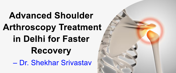 Advanced Shoulder Arthroscopy Treatment in Delhi