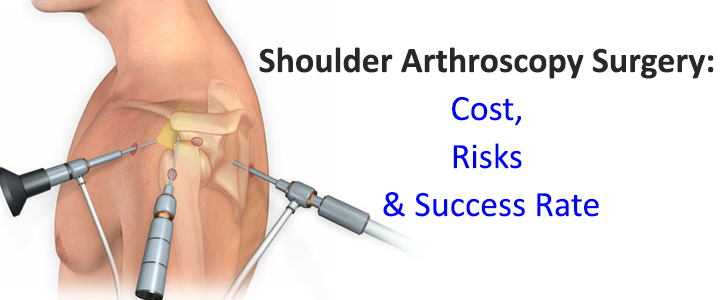 Shoulder Arthroscopy Surgery