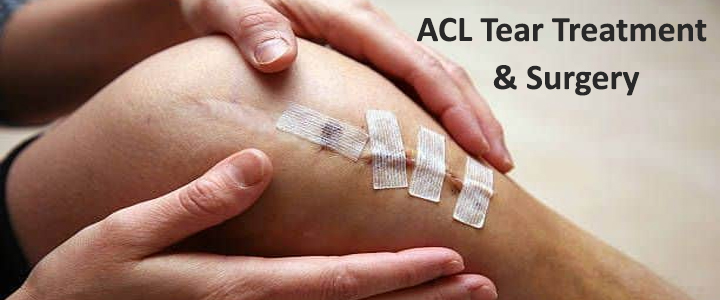 ACL Tear Treatment