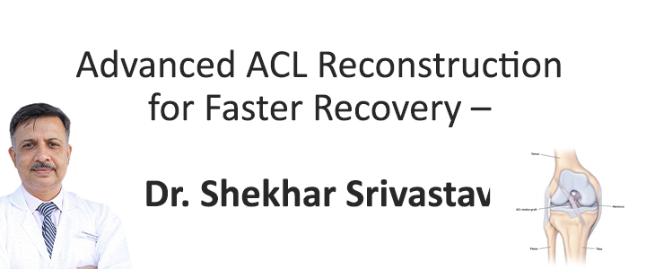 ACL Treatment
