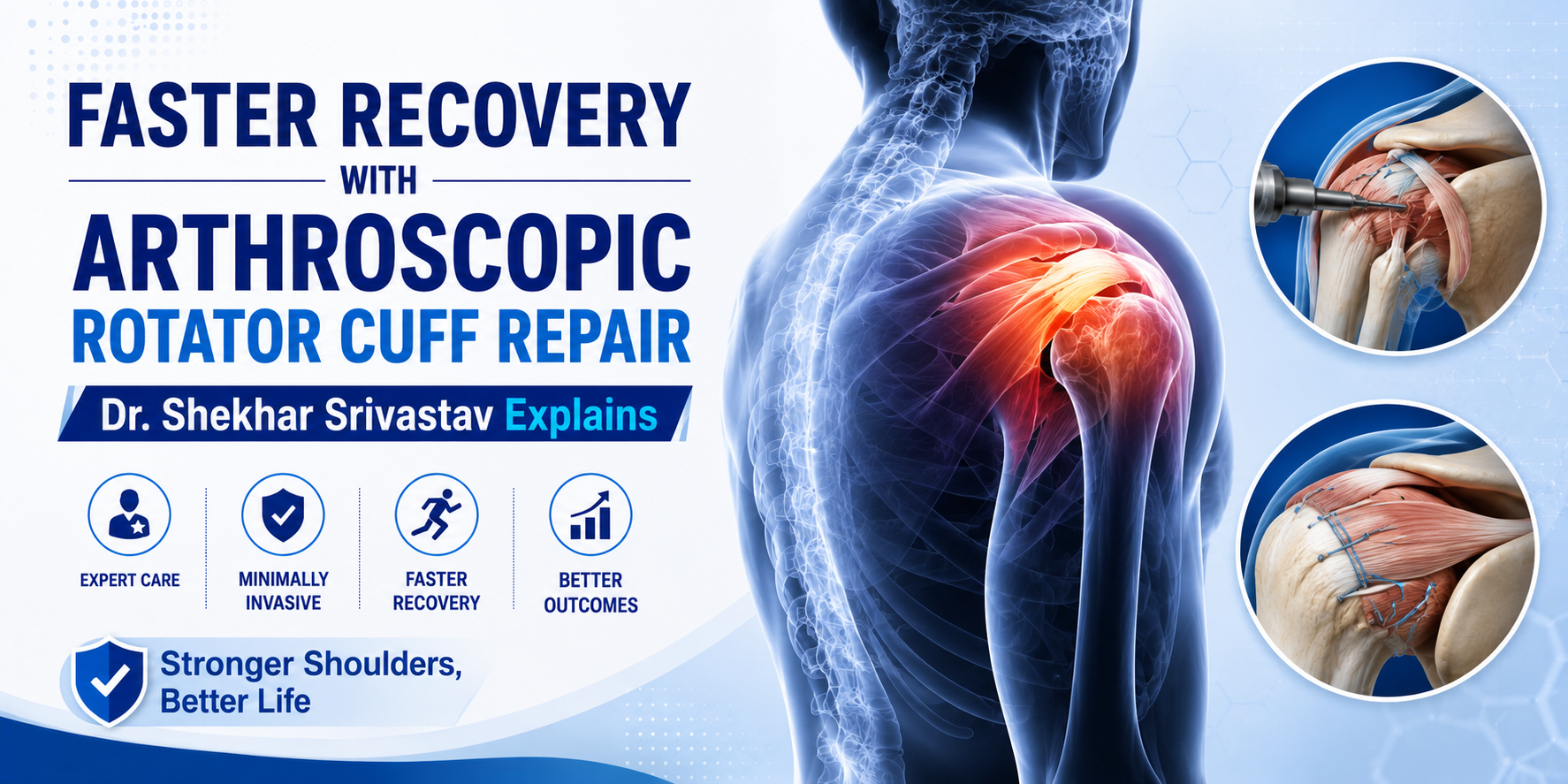 Faster Recovery with Arthroscopic Rotator Cuff Repair – Dr. Shekhar Srivastav Explains