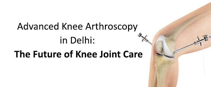 Advanced Knee Arthroscopy in Delhi