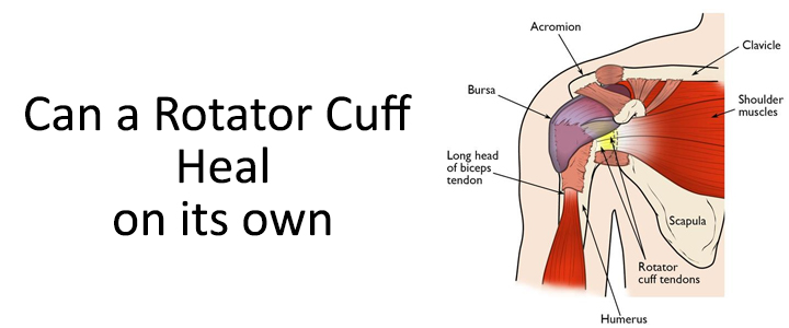 Can a Rotator Cuff Heal on its own?