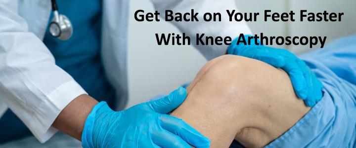 Knee Arthroscopy in Delhi