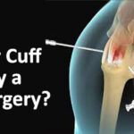 https://delhiarthroscopy.com/blog/2026/01/22/suffering-from-shoulder-pain-learn-about-arthroscopy-rotator-cuff-repair-by-dr-shekhar-srivastav/