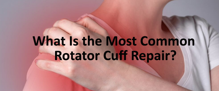 What Is the Most Common Rotator Cuff Repair?