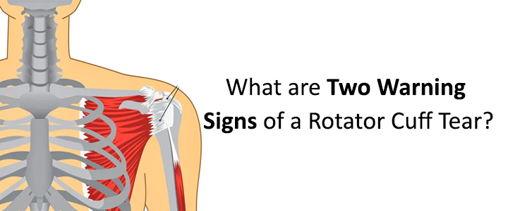 What are Two Warning Signs of a Rotator Cuff Tear?