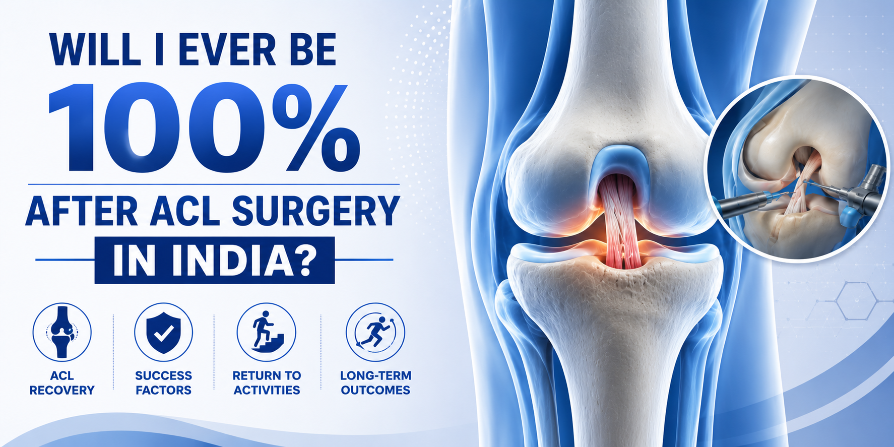 After ACL Surgery in India