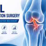 ACL Reconstruction Surgery