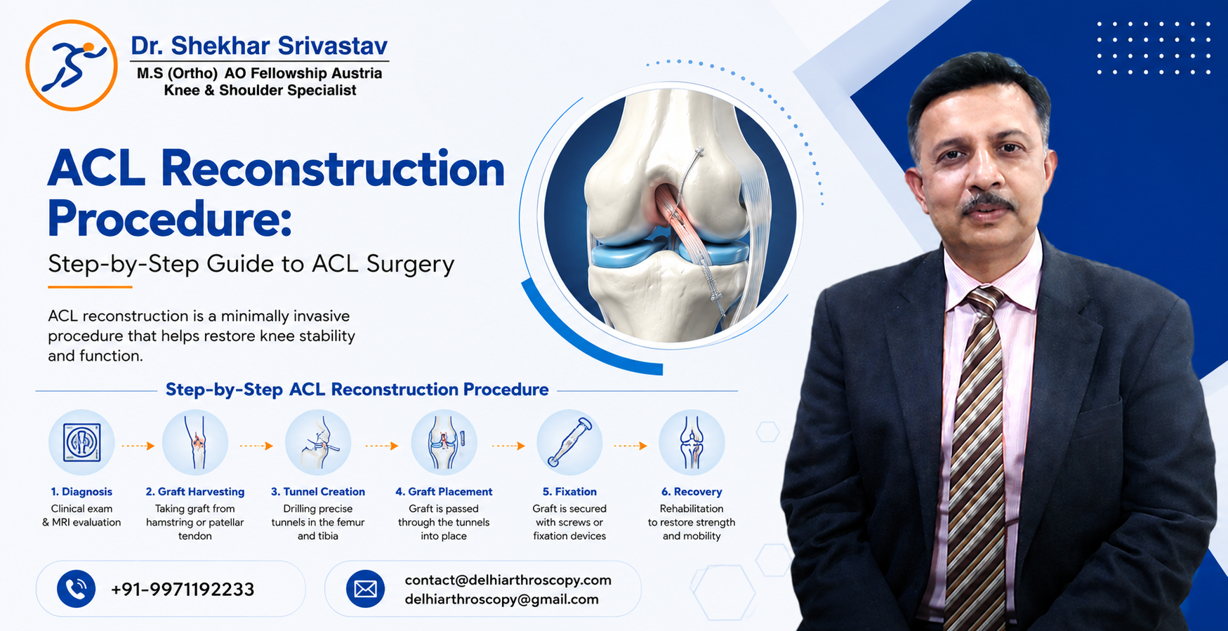ACL Reconstruction Procedure