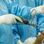 ACL reconstruction surgery