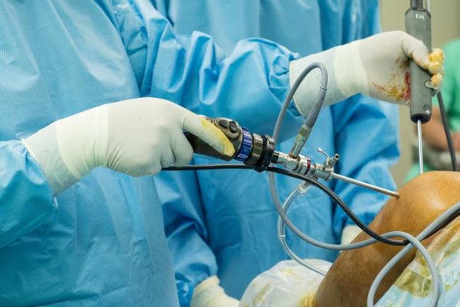 ACL reconstruction surgery
