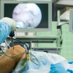 ACL surgery