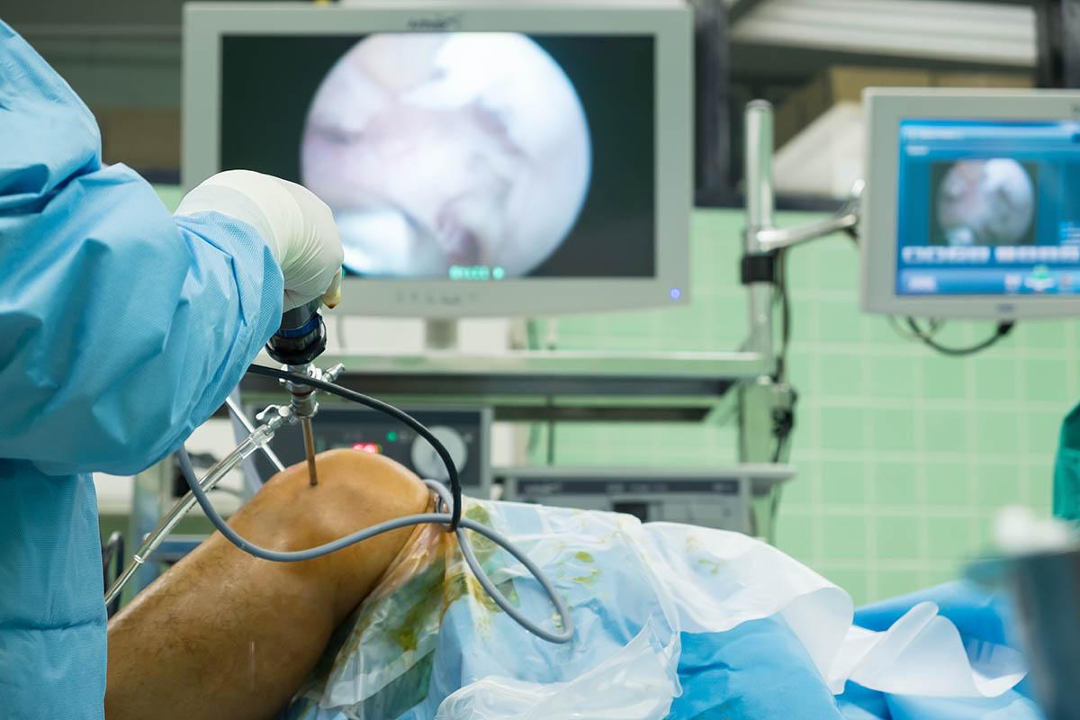 ACL surgery