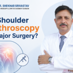 Is shoulder arthroscopy a major surgery?