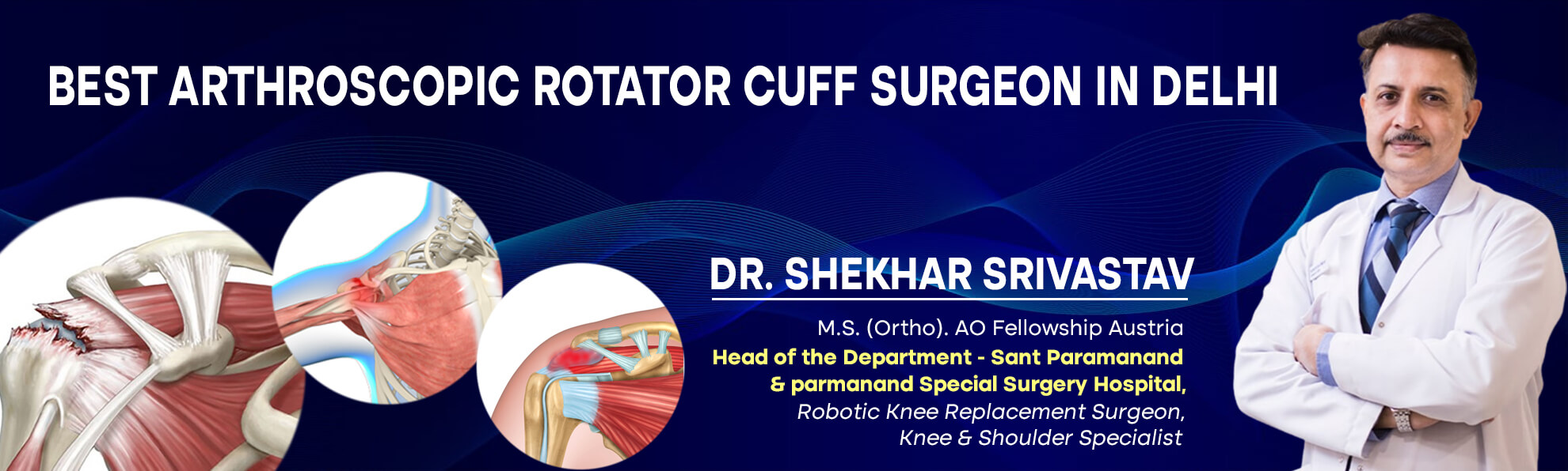 Arthroscopy-Rotator-Cuff-Repair