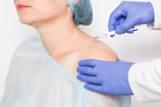 shoulder-arthroscopy-surgery-img