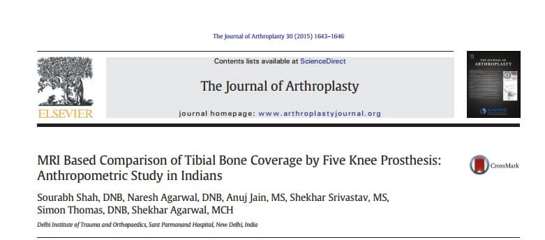 The Journal of Arthroplasty- Dr. Shekhar Srivastav