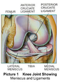 ACL Ligament Injury